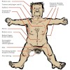 Adrian Injury Map - Code Grey, Comedy Festival 2011